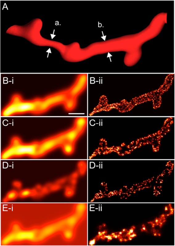 Revealing T-Tubules in Striated Muscle with New Optical Super-Resolution Microscopy Techniquess.