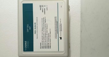 Ujawnienie elektrochemicznej konwersji nanokoloidów halogenku srebra poniżej 50 ms za pomocą elektrochemii stochastycznej i mikroskopii optycznej
